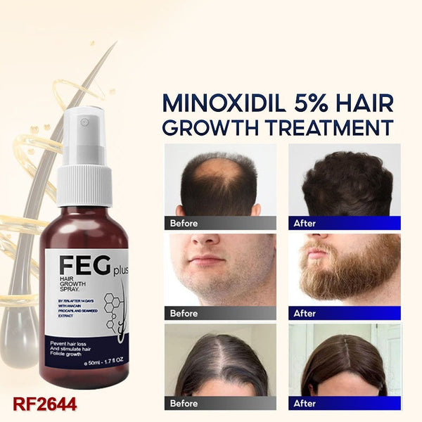 FEG Hair Growth Spray 50ml – Natural Anti Hair Loss Treatment for Thicker and Stronger Hair
